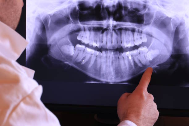 Best Root Canal Emergency Dentist  in Sharon, MS